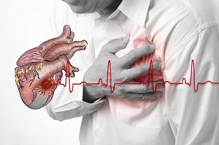 Bụi PM2.5 đẩy nhanh quy trình Apoptosis làm tăng nguy cơ tử vong ở bệnh tim mạch
