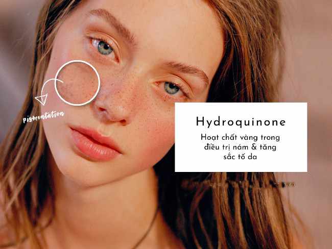 Hydroquinone trong treatment có nghĩa là gì vậy? Một chất làm trắng cực mạnh chuyên về trị nám, tàn nhang