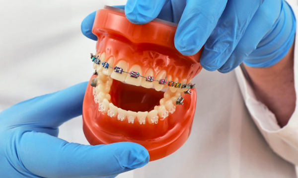 Bác sĩ chỉnh nha biết phương pháp cân bằng thẩm mỹ với chức năng để mang lại cho bạn kết quả hoàn hảo và cải thiện sức khỏe răng miệng của bạn.