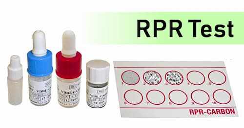 Xét nghiệm RPR là gì?