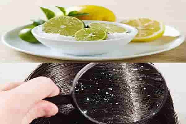 Axit citric trong chanh có tác dụng các loại bỏ dầu thừa ở trên tóc và da đầu nhanh chóng